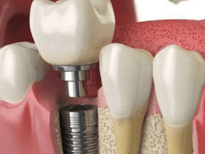 Sante Dental Centre (Private)